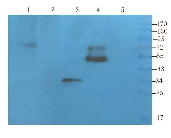 Krox-20 Rabbit Polyclonal Antibody