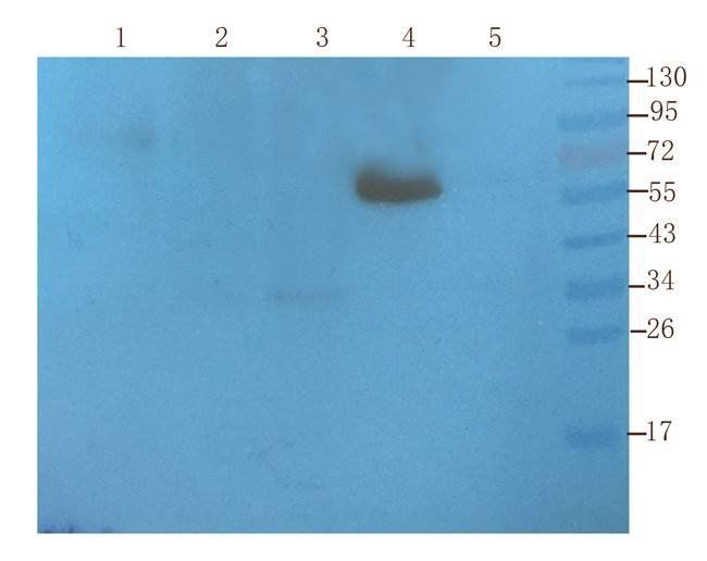 Krox-20 Rabbit Polyclonal Antibody