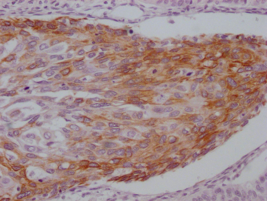 KRT15 Antibody