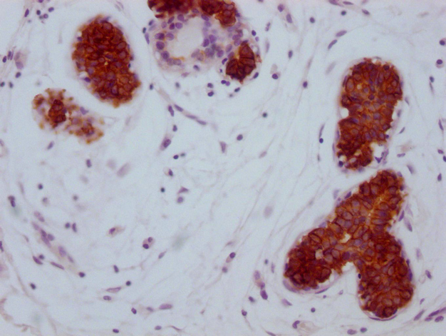 KRT15 Antibody
