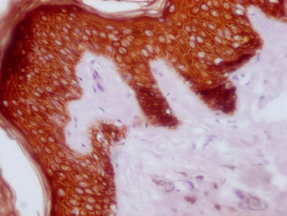 KRT14/KRT16/KRT5/KRT6A/KRT8 Antibody