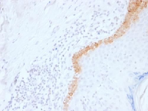 KRT15 Antibody