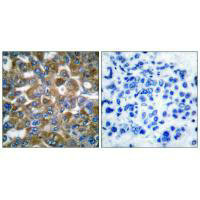 KRT15 Antibody