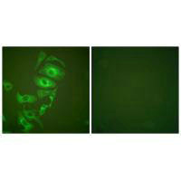 KRT17 Antibody