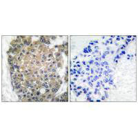 KRT17 Antibody
