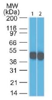 KRT18 Antibody