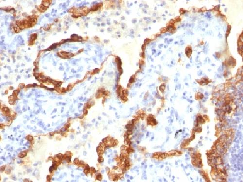 KRT18 Antibody