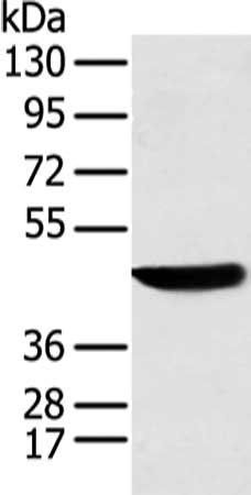 KRT18 Antibody