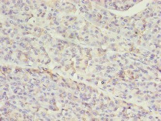 SETD7 Antibody
