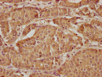 KRT20 Antibody