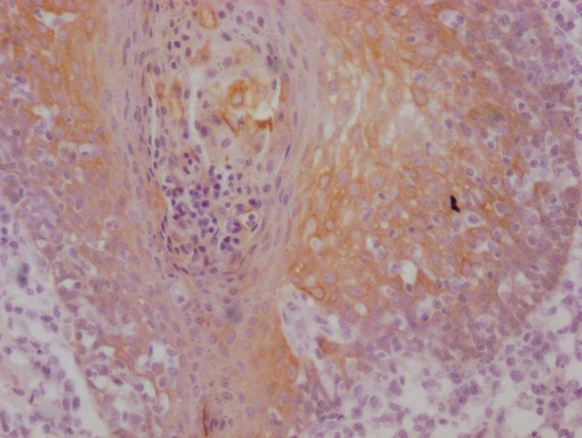KRT5/KRT6A Antibody