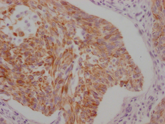 KRT5/KRT6A Antibody