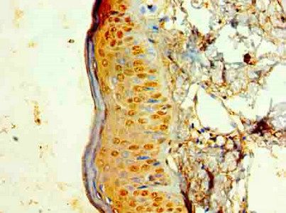KRT6A Antibody