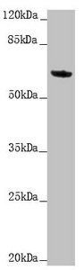 KRT6A Antibody