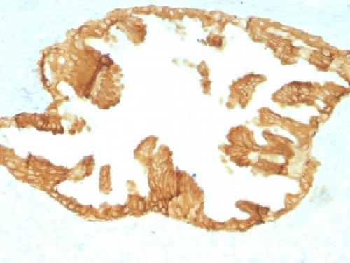 KRT76 Antibody