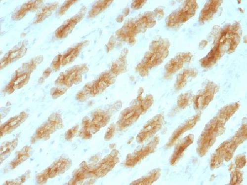 KRT76 Antibody