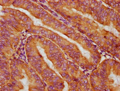 KRT76 Antibody