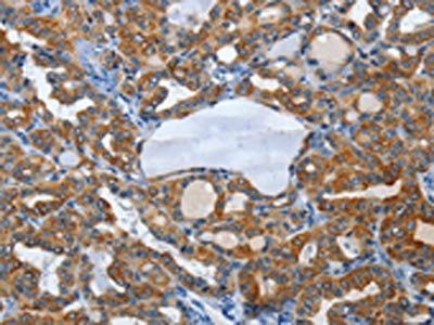 KRT81 Antibody