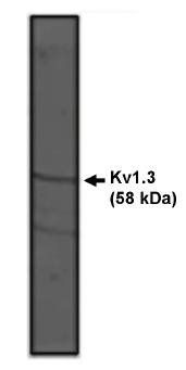 Rabbit anti Rat Kv1.3 Potassium Channel Antibody
