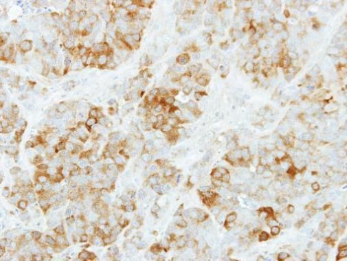 KYNU Rabbit Polyclonal Antibody