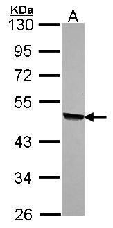 KYNU Rabbit Polyclonal Antibody