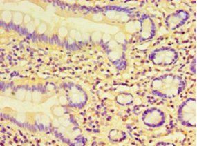 KYAT1 Antibody