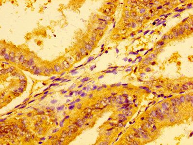 LDHA Antibody
