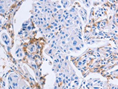 LAIR1 Antibody