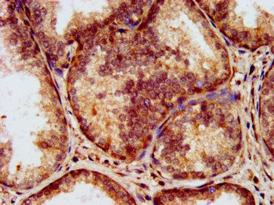 LAMA2 Antibody