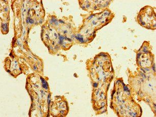 LAMA5 Antibody
