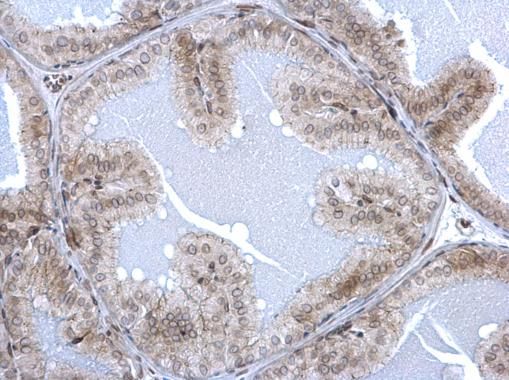 Lamin A + C Rabbit Polyclonal Antibody