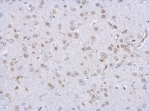 Lamin A + C Rabbit Polyclonal Antibody