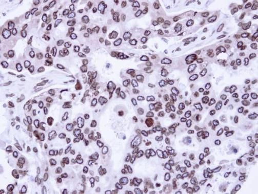 Lamin A + C Rabbit Polyclonal Antibody