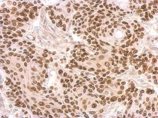 Lamin B2 Rabbit Polyclonal Antibody