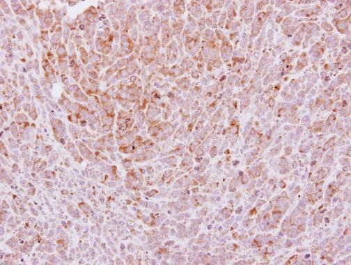 CD41 Rabbit Polyclonal Antibody