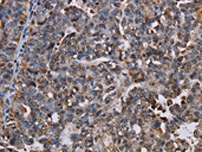 LBR Antibody