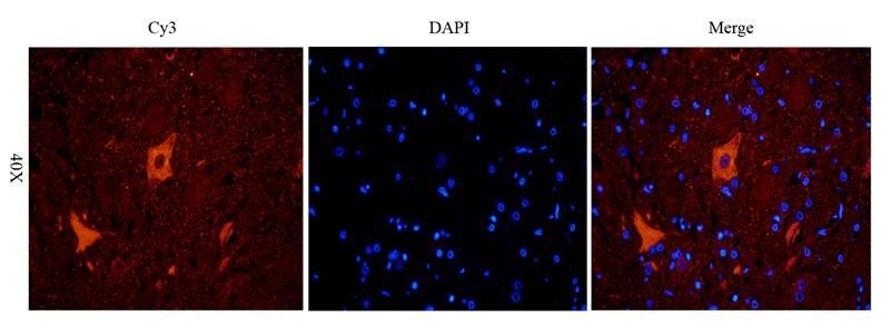 LC3 Rabbit Polyclonal Antibody