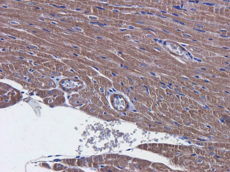 LC3 Rabbit Polyclonal Antibody
