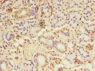 LDAH Antibody