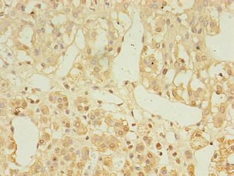 LDAH Antibody