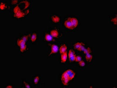 LDHD Antibody