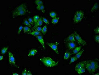 LDLR Antibody