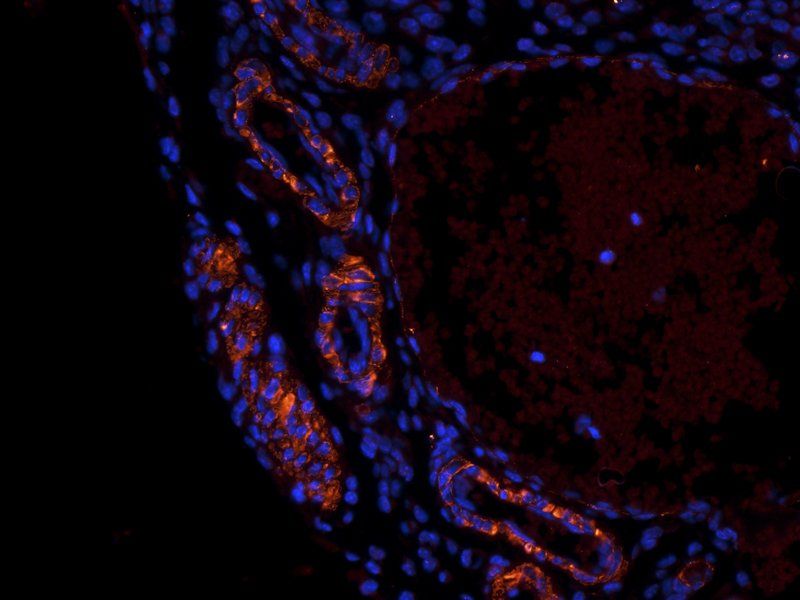 Leptin Rabbit Polyclonal Antibody