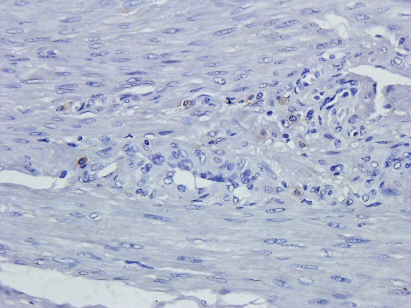 Leptin Rabbit Polyclonal Antibody