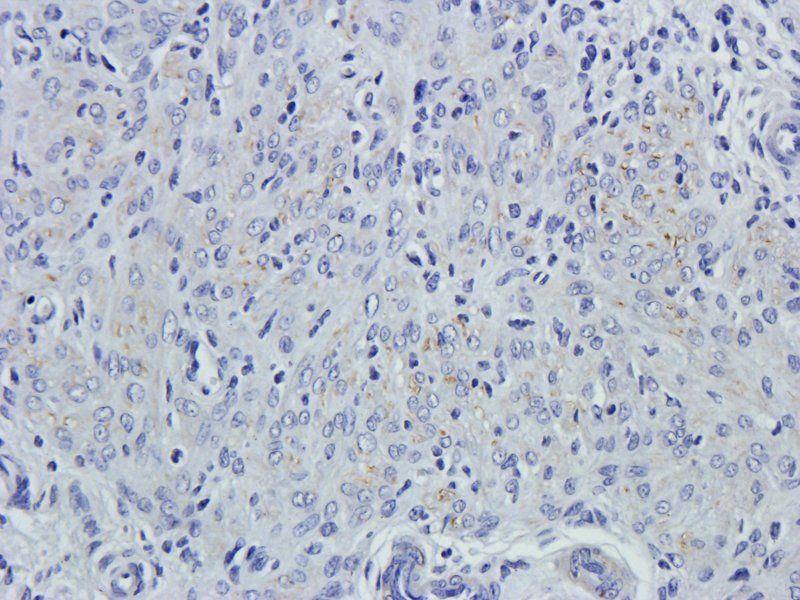 Leptin Rabbit Polyclonal Antibody