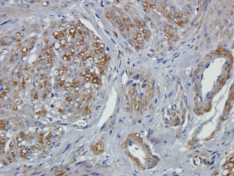 Leptin Rabbit Polyclonal Antibody