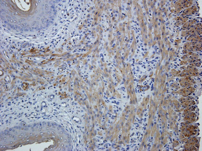 Leptin Rabbit Polyclonal Antibody