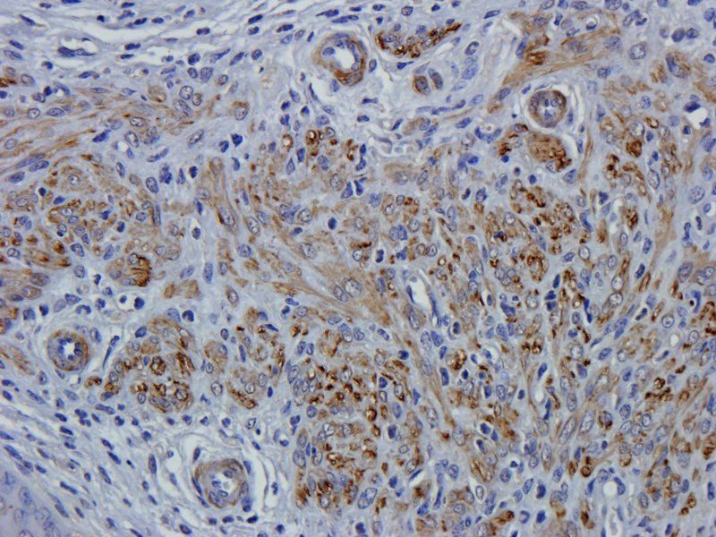 Leptin Rabbit Polyclonal Antibody