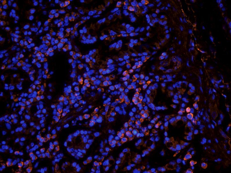 Leptin Receptor Rabbit Polyclonal Antibody