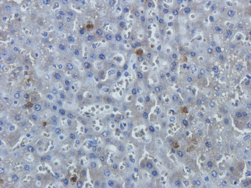 Leptin Receptor Rabbit Polyclonal Antibody